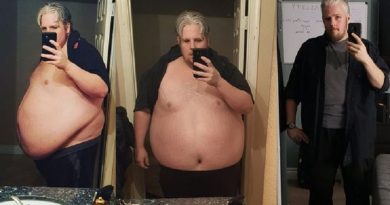 Unbelievable Weight Loss Transformation